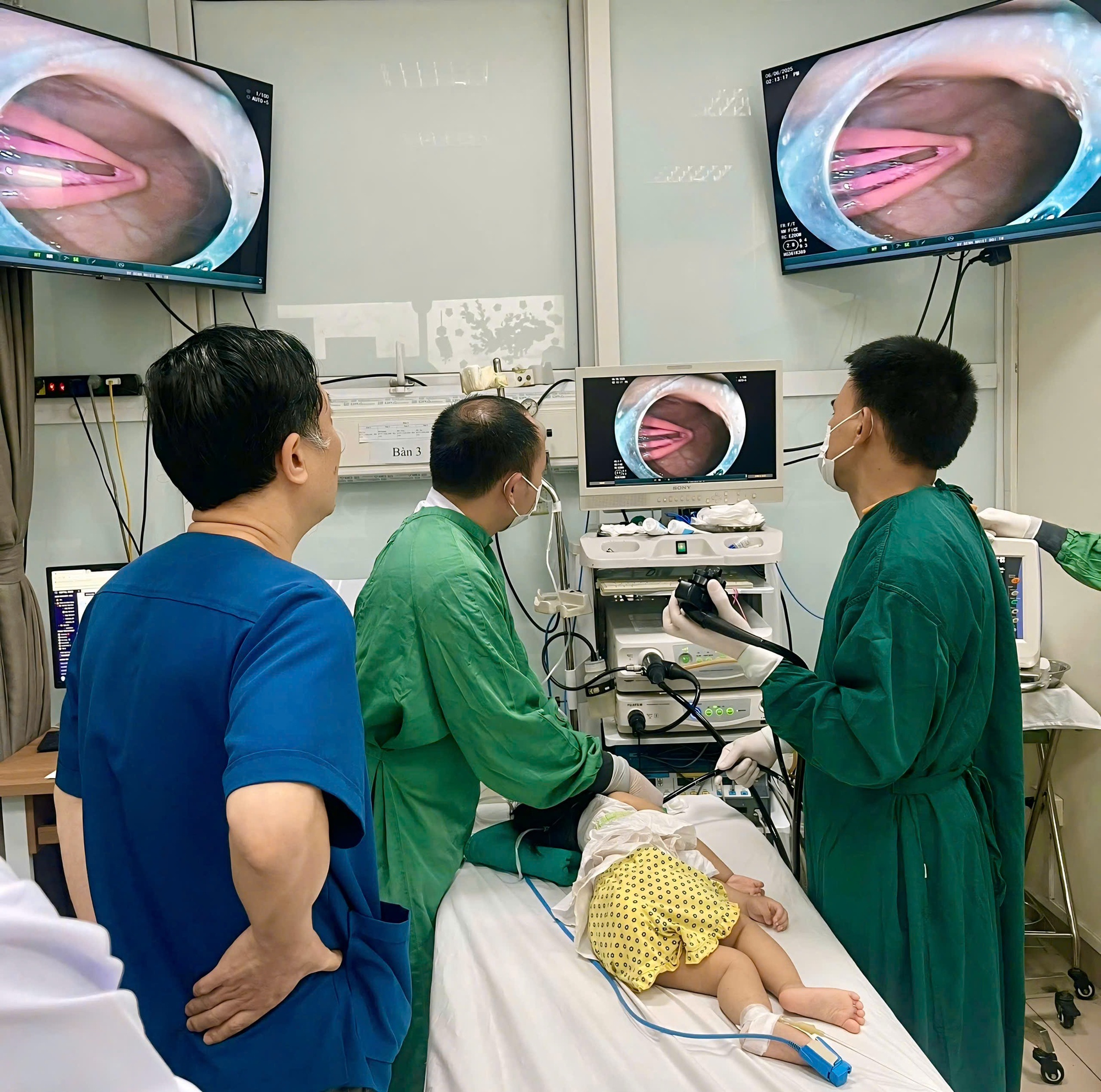 Hà Nội: Bé gái 21 tháng tuổi nhập viện vì trẻ nhỏ nuốt dị vật kẹp tóc kim lọai - Ảnh 1.