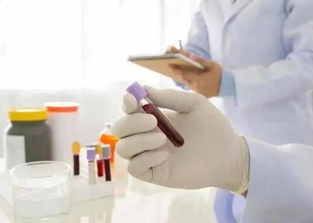 Nếu cứ uống nước như thế này, mạch máu của bạn sẽ bị hủy hoại: Có 3 điều không nên làm khi uống nước- Ảnh 3.