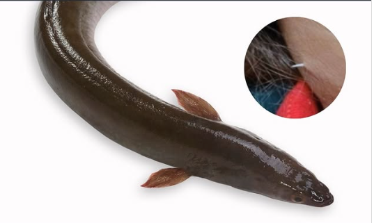 Người phụ nữ vô tình nuốt phải xương cá trong lúc ăn canh, 2 tuần sau chuyện kinh khủng xảy ra - Ảnh 4.