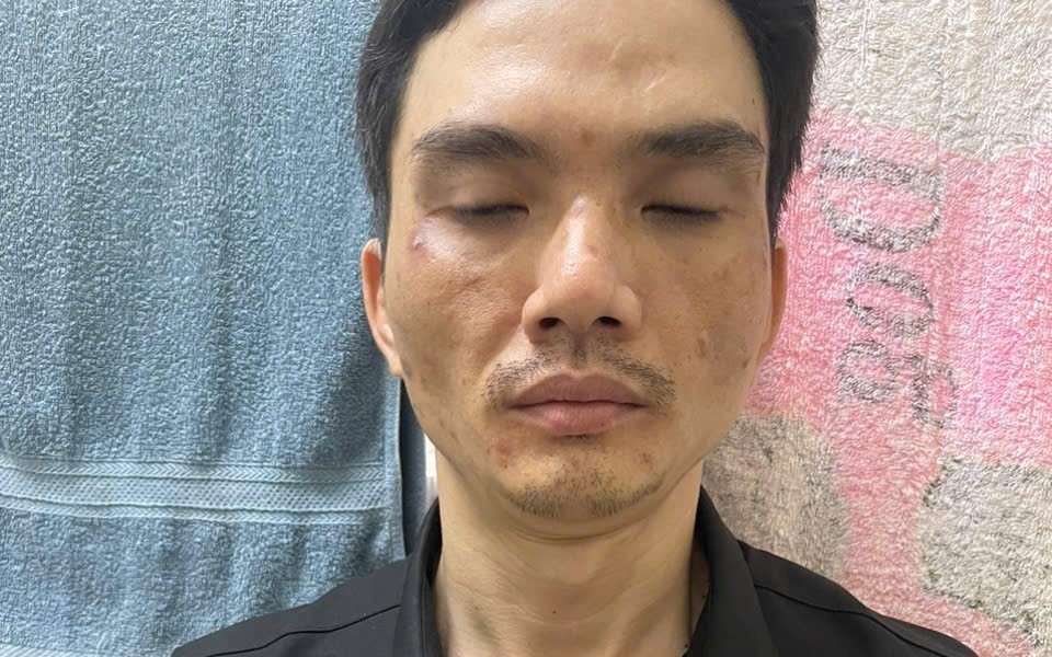 Bắt khẩn cấp Nguyễn Đức Thôi - kẻ xông vào bệnh viện đánh "tình địch" - Ảnh 2.