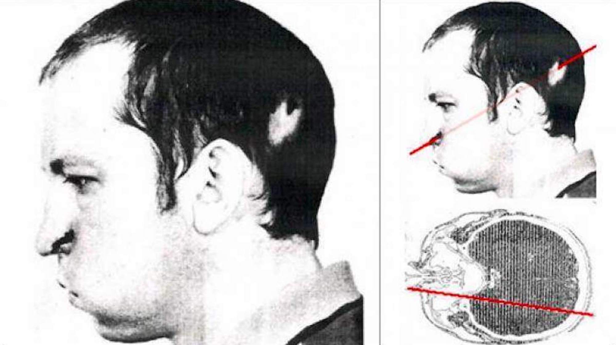 Công nghệ laser mới giúp chụp ảnh não an toàn hơn và hiệu quả hơn - Ảnh 2. Công nghệ laser mới giúp chụp ảnh não an toàn hơn và hiệu quả hơn - Ảnh 2.