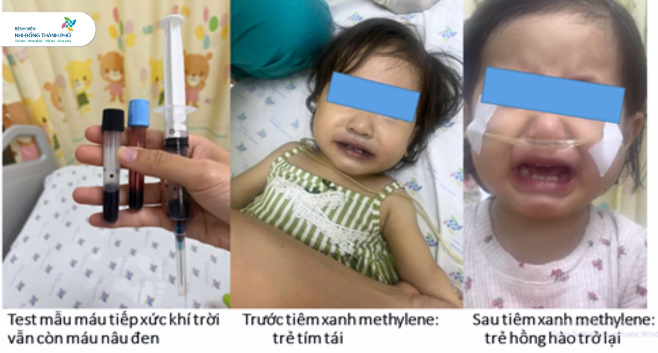 Dùng nước giếng nấu ăn, máu của bé gái chuyển nâu- Ảnh 1. Dùng nước giếng nấu ăn, máu của bé gái chuyển nâu- Ảnh 1.