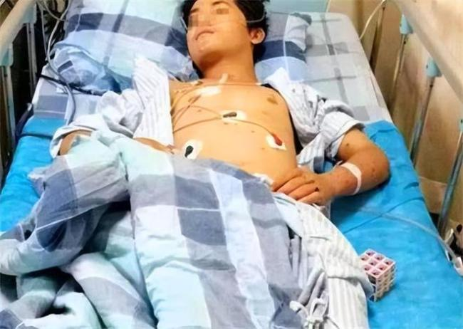 Chàng trai 17 tuổi suy thận giai đoạn cuối vì ăn quá nhiều 2 món nhưng vì
