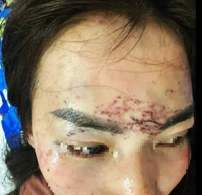 Khởi tố 2 phụ nữ trong Vụ đánh ghen Tại Cà Mau gây chấn động dư luận - Ảnh 1.