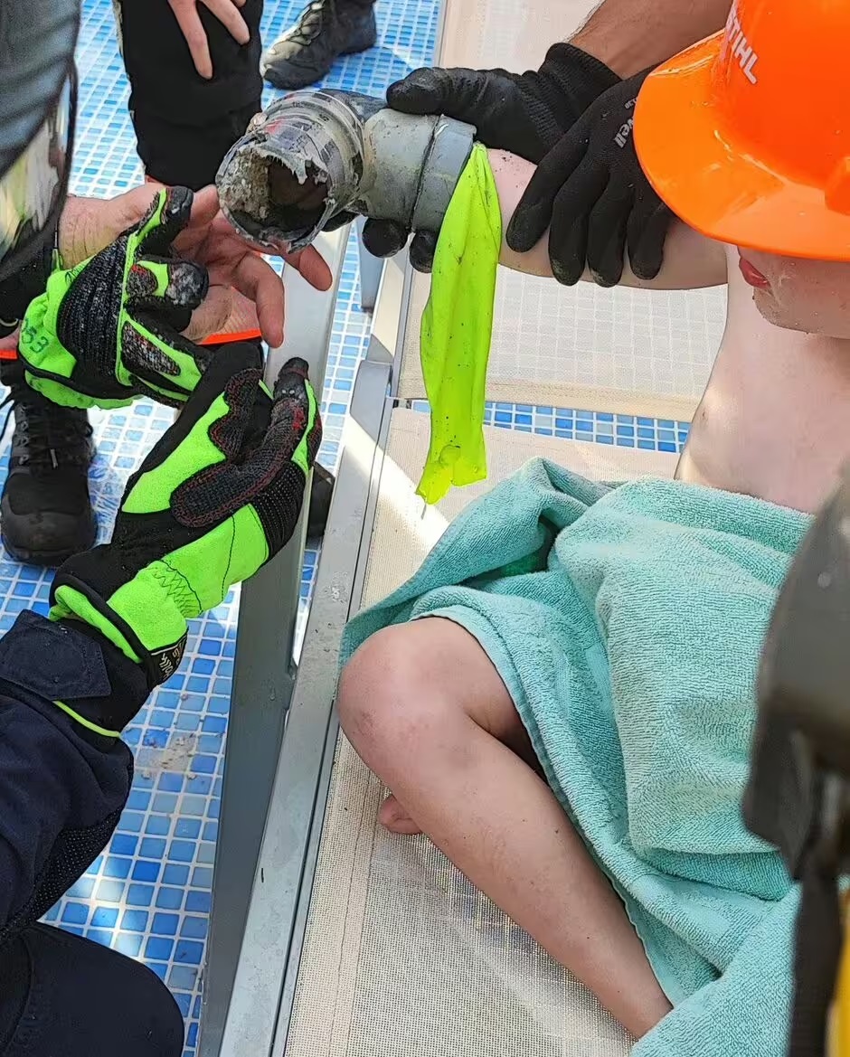 Bé trai 4 tuổi suýt mất cánh tay vì bị hút vào hệ thống lọc nước hồ bơi - Ảnh 1.