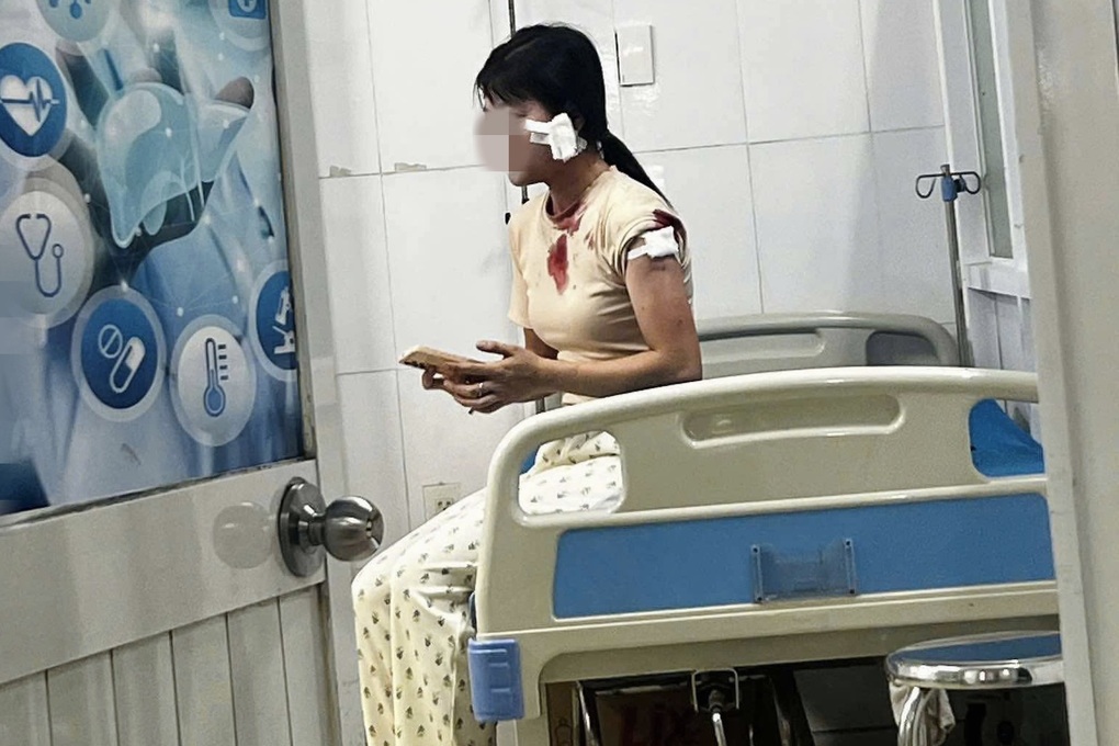 Vụ chồng cũ đánh vợ ở Bình Dương: Nguồn cơn đằng Sau vụ tấn công gây sốc - Ảnh 2. Vụ chồng cũ đánh vợ ở Bình Dương: Nguồn cơn đằng Sau vụ tấn công gây sốc - Ảnh 2.