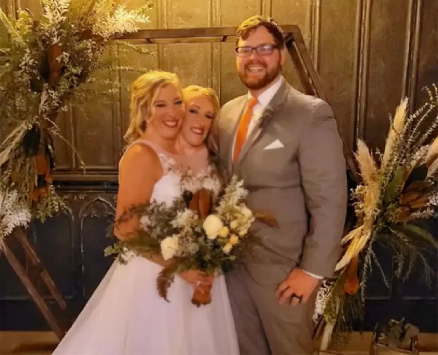 Cặp song sinh dính liền nổi tiếng nhất thế giới bây giờ ra sao sau khi 1 người đã kết hôn?- Ảnh 4.