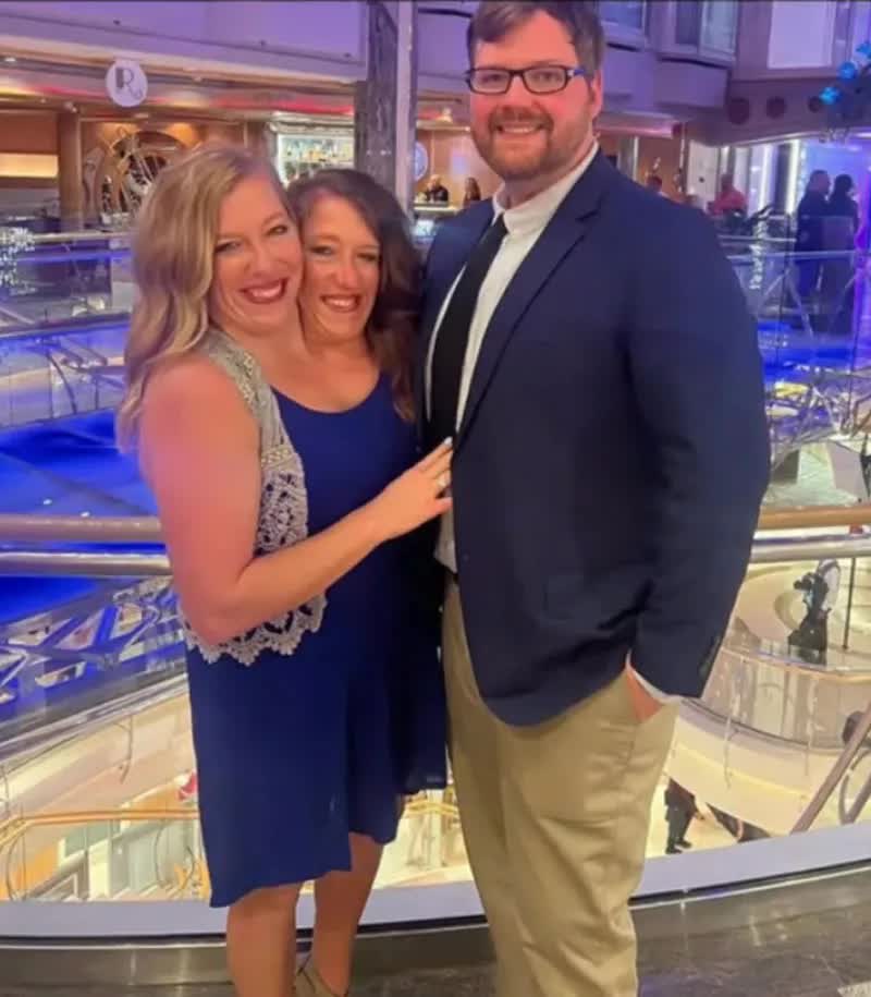 Cặp song sinh dính liền nổi tiếng nhất thế giới bây giờ ra sao sau khi 1 người đã kết hôn?- Ảnh 5.