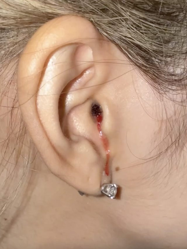 Tình trạng báo động của Lisa trước thềm BLACKPINK comeback- Ảnh 1. Tình trạng báo động của Lisa trước thềm BLACKPINK comeback- Ảnh 1.