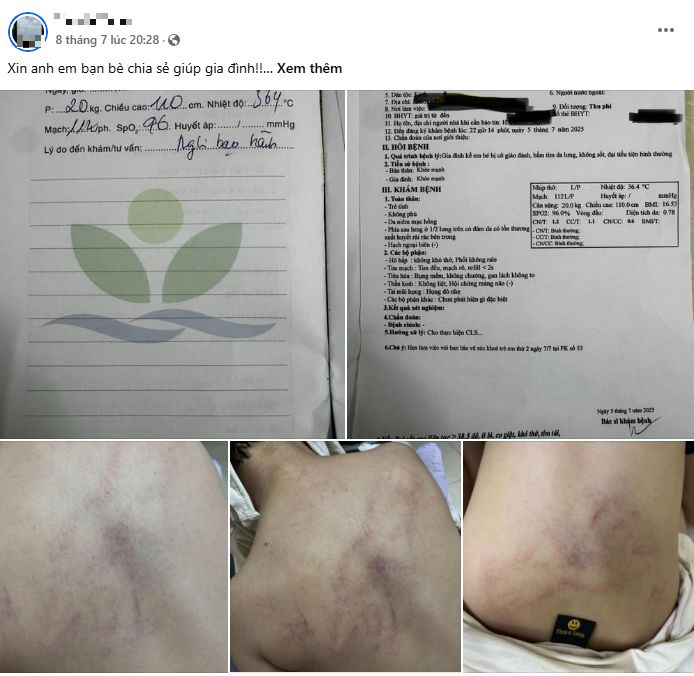 - Ảnh 1.