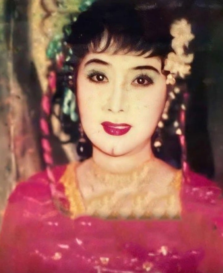 - Ảnh 1.