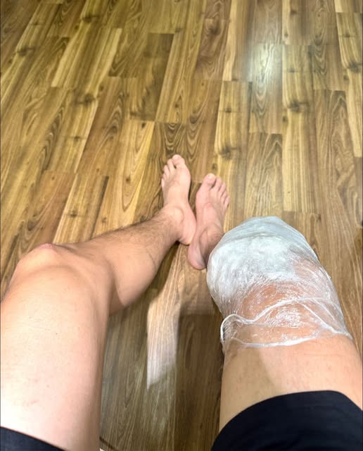 Tình trạng nghiêm trọng của nam thần VFC sau 1 năm bị đứt dây chằng chéo trước- Ảnh 1. Tình trạng nghiêm trọng của nam thần VFC sau 1 năm bị đứt dây chằng chéo trước- Ảnh 1.
