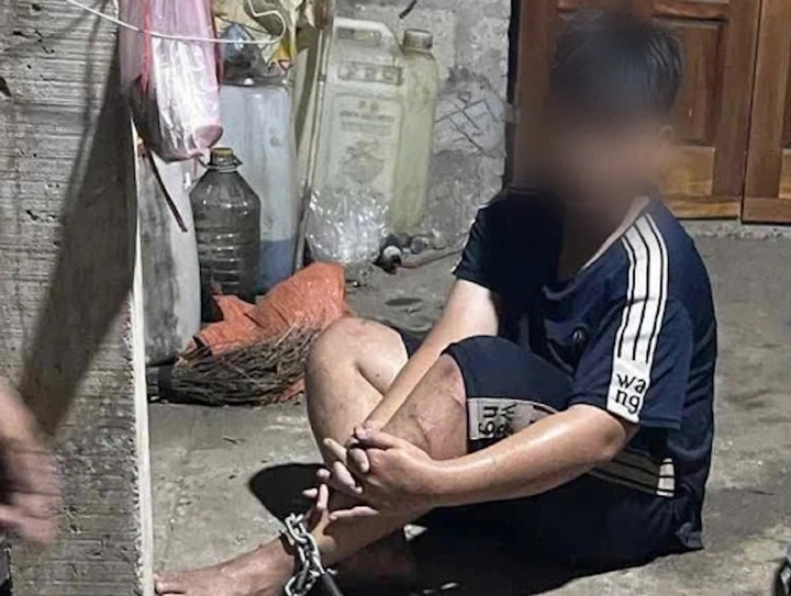 Làm rõ vụ nam sinh Huế bị xích chân và hành hung nghiêm trọng - Ảnh 1.