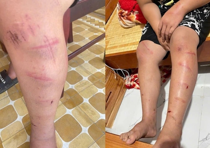 Làm rõ vụ nam sinh Huế bị xích chân và hành hung nghiêm trọng - Ảnh 2.