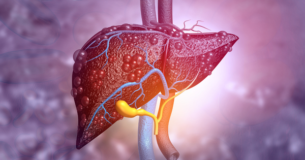 Khi mỡ "xâm lấn" và tàn phá gan, cơ thể sẽ sưng ở 5 chỗ: Có 1 cũng cần đi khám gấp - Ảnh 3.