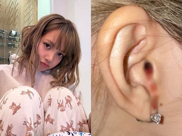 - Ảnh 1.