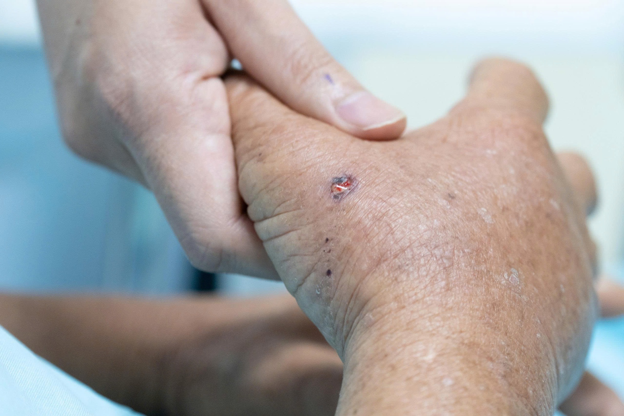 Người đàn ông ở Đà Nẵng bị ong đốt đến hôn mê, suýt chết - Ảnh 3.