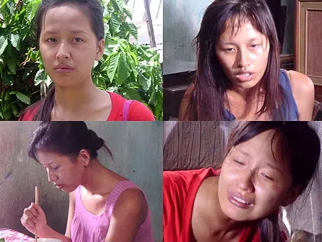 - Ảnh 1. - Ảnh 1.