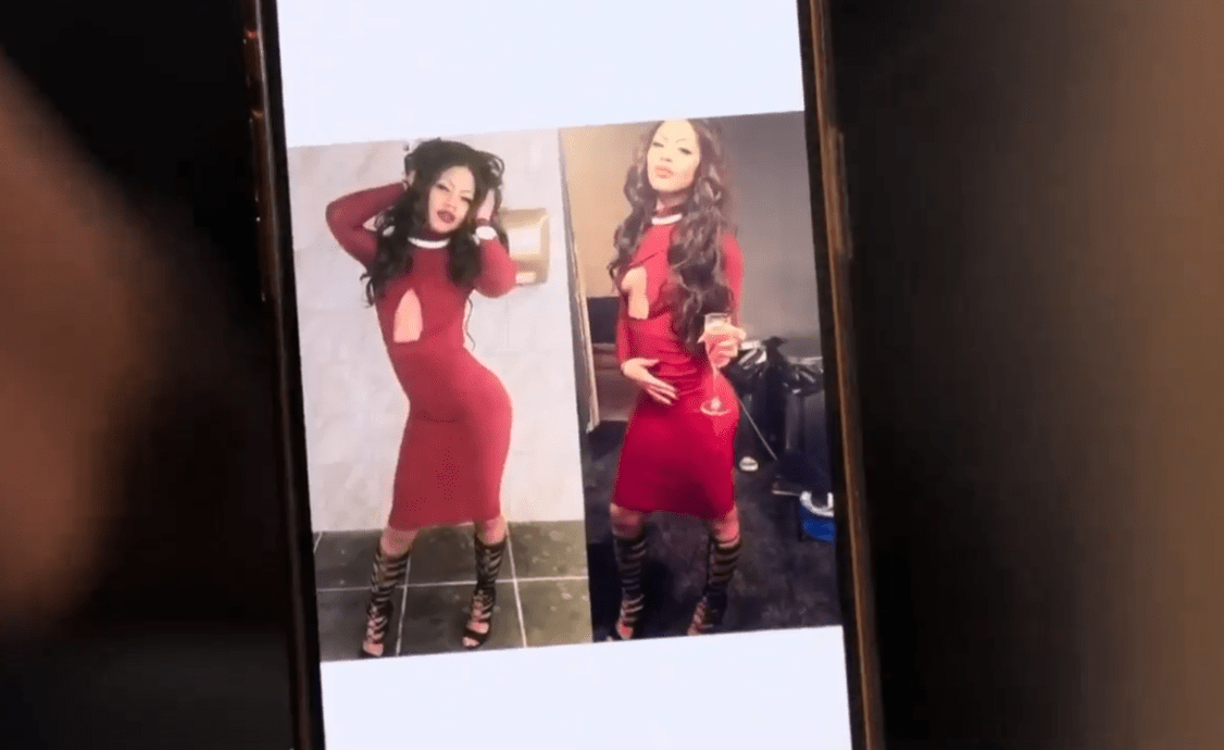 Chi hơn 3 tỷ phẫu thuật "vòng 3", người phụ nữ hoảng loạn khi nhìn kết quả ở phòng tập gym - Ảnh 3. Chi hơn 3 tỷ phẫu thuật "vòng 3", người phụ nữ hoảng loạn khi nhìn kết quả ở phòng tập gym - Ảnh 3.