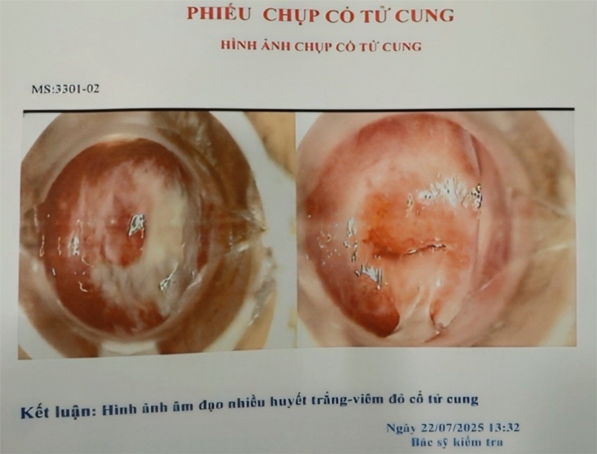 - Ảnh 2.