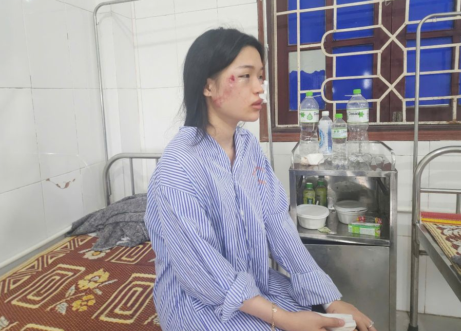 Nạn nhân vụ xe khách lật ở Hà Tĩnh kể lại khoảnh khắc kinh hoàng trong đêm - Ảnh 1.
