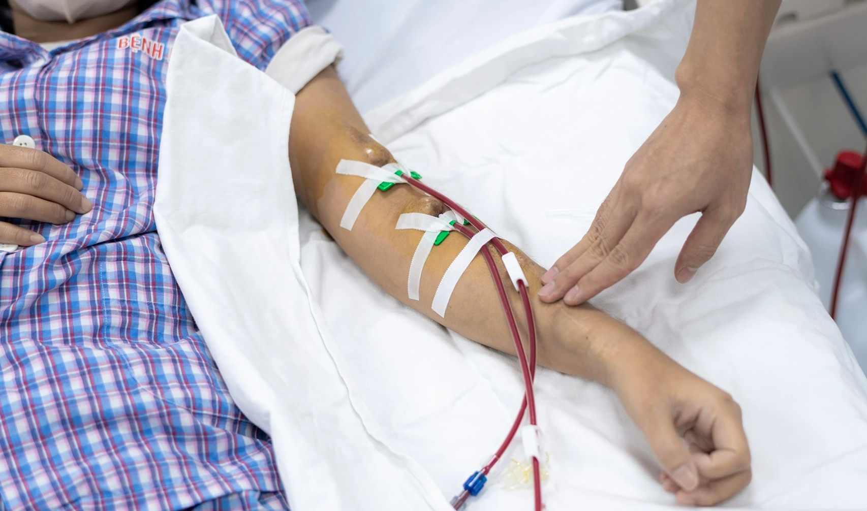 Thức đêm triền miên, ăn uống qua loa, kỹ sư 28 tuổi suy thận giai đoạn cuối, phải sống nhờ máy lọc máu - Ảnh 2.