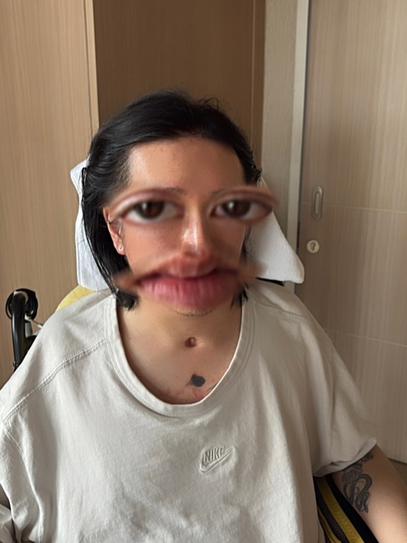 - Ảnh 1.