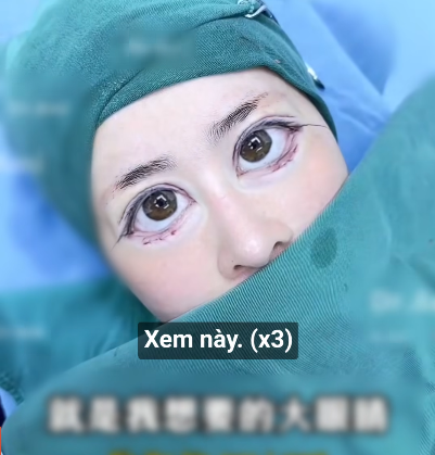 - Ảnh 2.