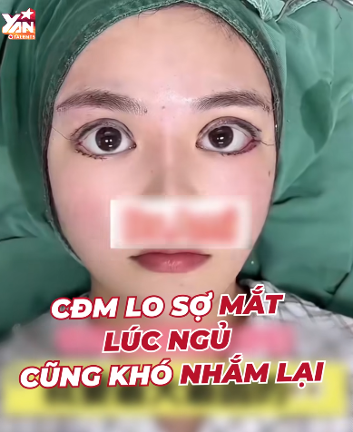 - Ảnh 4.