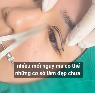 - Ảnh 3.