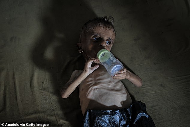 Bức ảnh gây sốc về trẻ em Gaza: Thảm kịch nhân đạo khiến thế giới bàng hoàng - Ảnh 5.