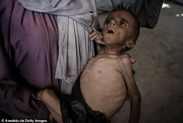 Bức ảnh gây sốc về trẻ em Gaza: Thảm kịch nhân đạo khiến thế giới bàng hoàng - Ảnh 3.