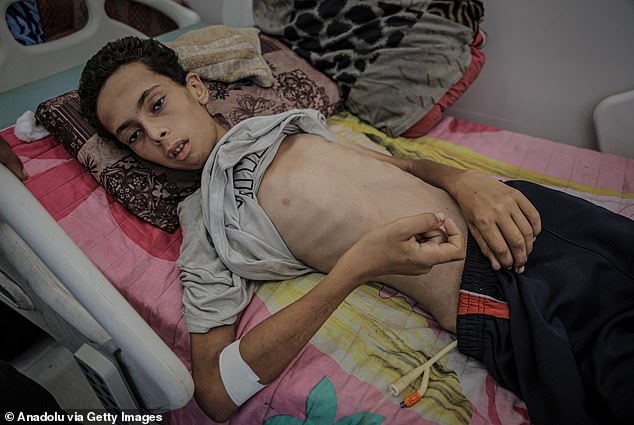 Bức ảnh gây sốc về trẻ em Gaza: Thảm kịch nhân đạo khiến thế giới bàng hoàng - Ảnh 6.