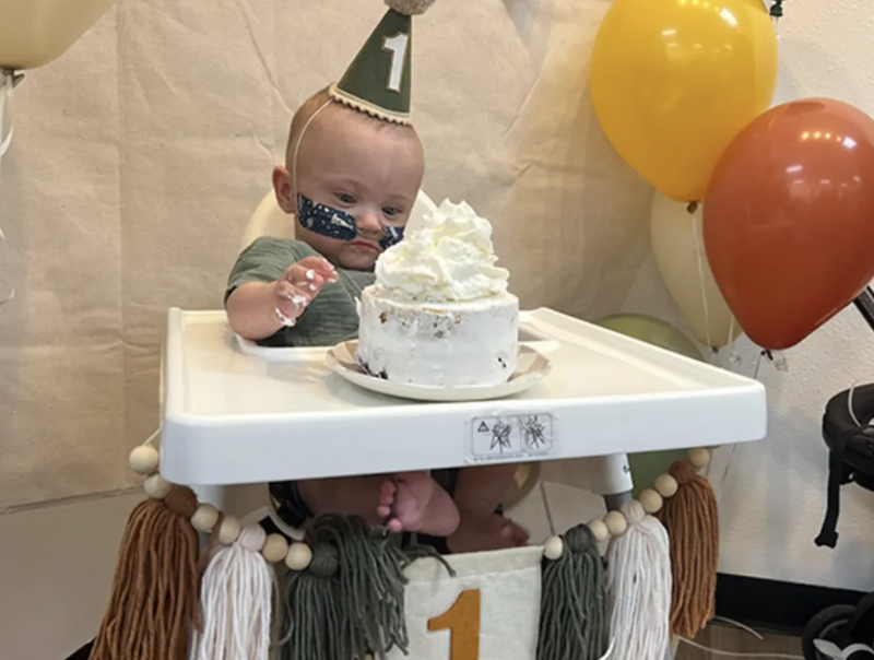 Em bé "sinh non nhất thế giới" nặng 285 gam, dài 24cm khi mới chào đời, sau 1 năm giờ ra sao?- Ảnh 2.