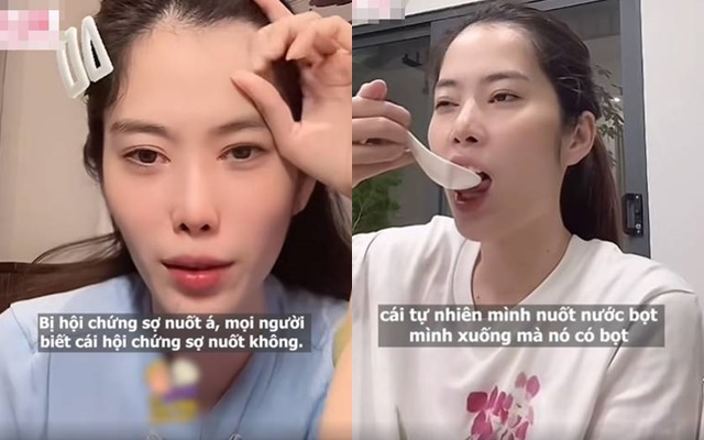 Nam Em mắc hội chứng lạ- Ảnh 1. Nam Em mắc hội chứng lạ- Ảnh 1.
