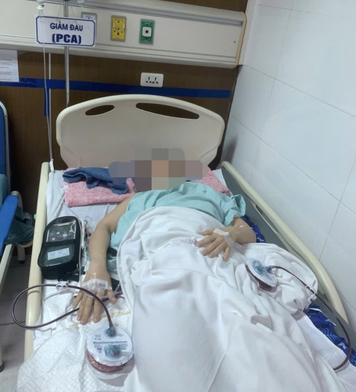 Vụ sập khung đèn tiệc cưới khiến cô gái thương tật 96%: Nạn nhân có quyền yêu cầu bồi thường bao nhiêu tiền? - Ảnh 1. Vụ sập khung đèn tiệc cưới khiến cô gái thương tật 96%: Nạn nhân có quyền yêu cầu bồi thường bao nhiêu tiền? - Ảnh 1.