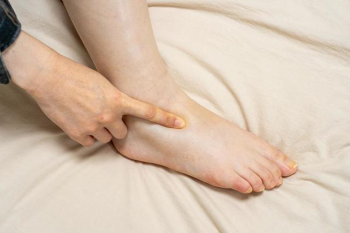 7 dấu hiệu của ung thư bàng quang, rất nhiều người CHƯA TỪNG ĐỂ Ý! - Ảnh 3.