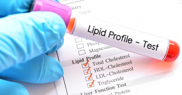 Lý do bất ngờ khiến bạn dễ bị máu nhiễm mỡ tấn công - Ảnh 2.