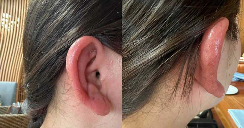 Loại khuy&ecirc;n tai b&aacute;n chạy tr&ecirc;n c&aacute;c s&agrave;n thương mại điện tử n&agrave;y tiềm ẩn chất độc, n&ecirc;n bỏ ngay kẻo hối kh&ocirc;ng kịp- Ảnh 1.