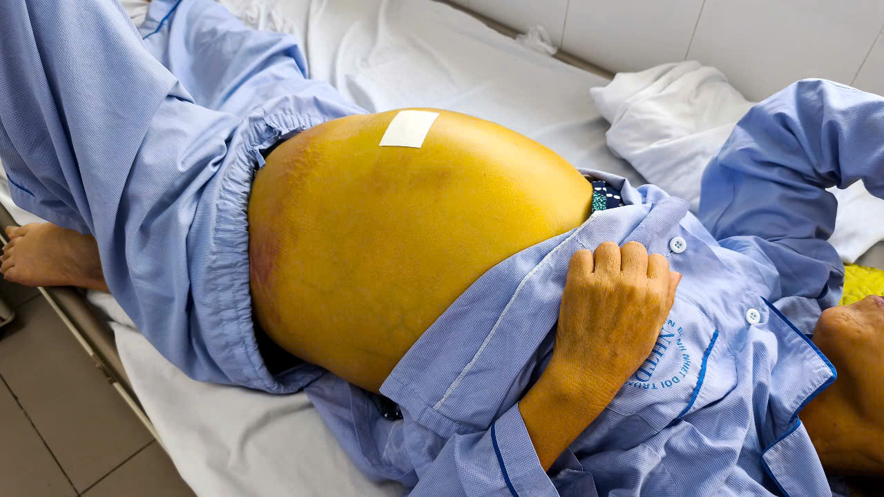 - Ảnh 1.
