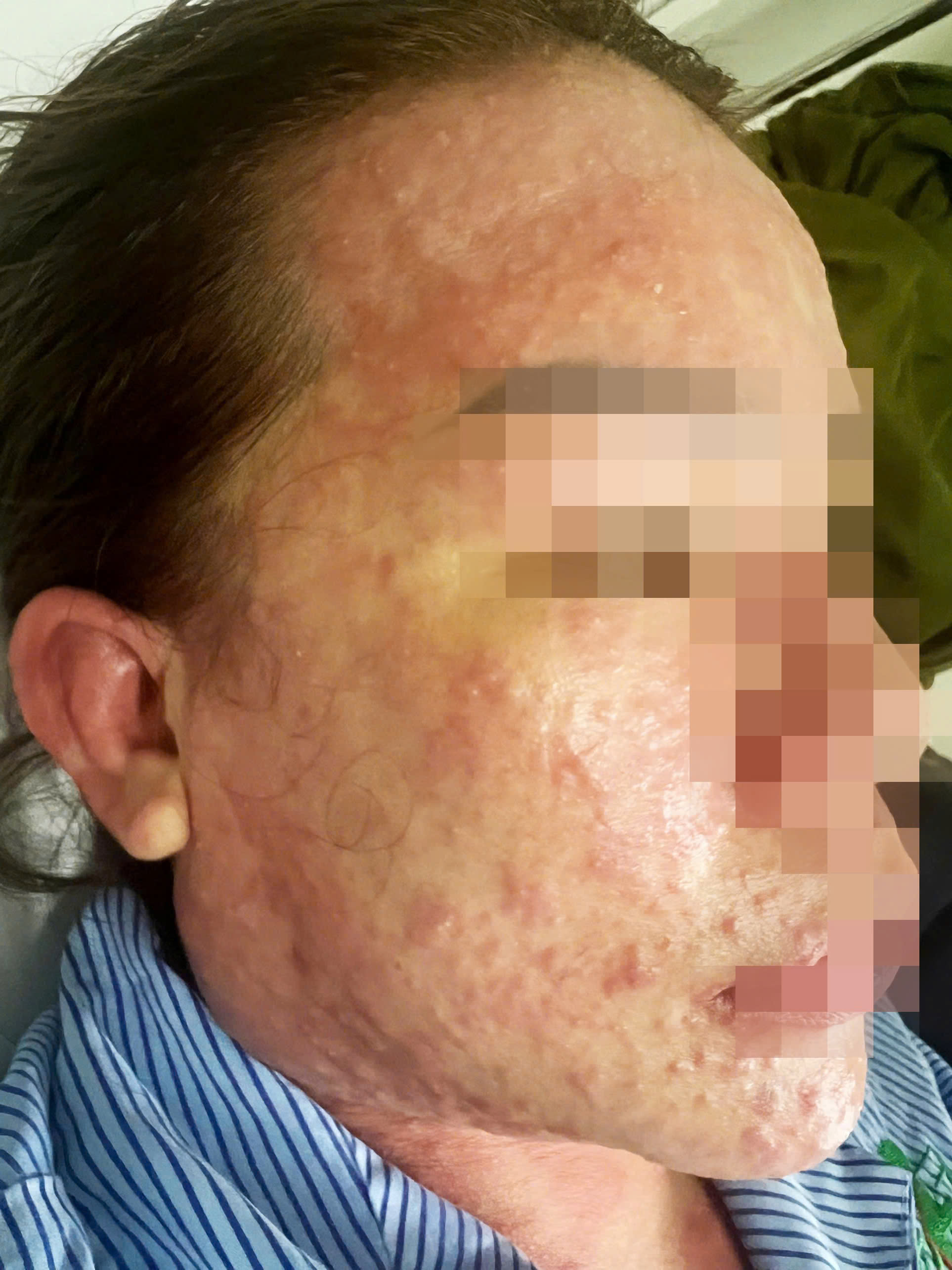 Một phụ nữ suýt chết khi uống collagen, thuốc giảm cân mua trên mạng- Ảnh 1.