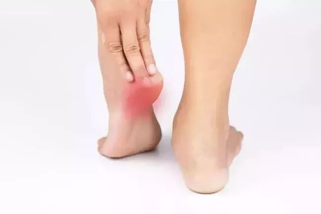 Nhìn bàn chân không có 2 dấu hiệu này thì thận của bạn đang rất tốt, nếu thấy đâu ở 2 vị trí thì nên đi khám thận ngay- Ảnh 3.