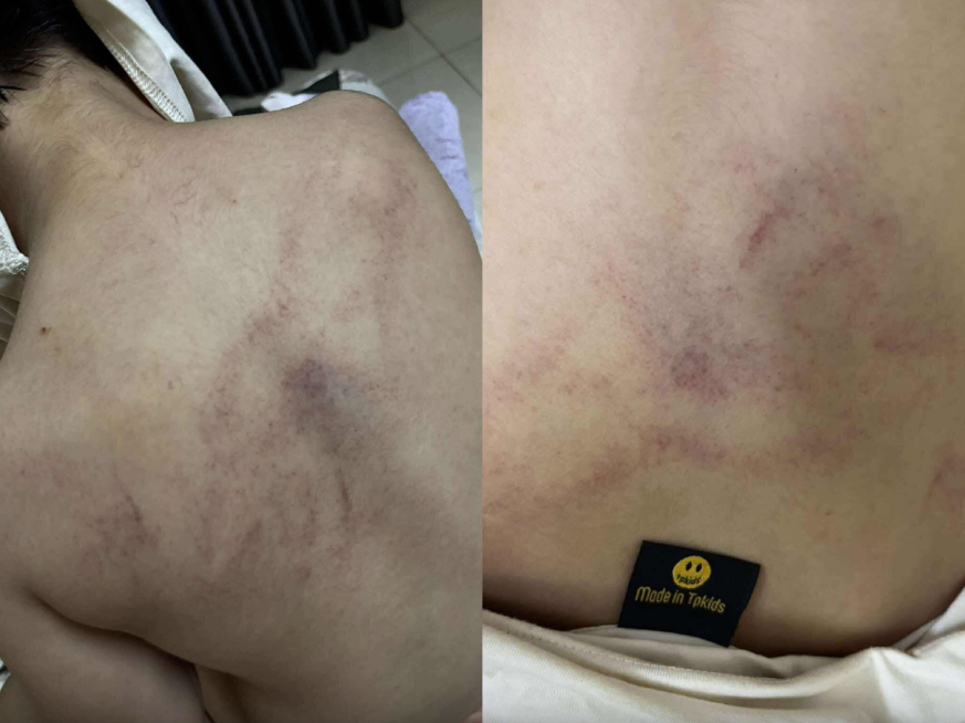 B&eacute; g&aacute;i 4 tuổi bị c&ocirc; gi&aacute;o bạo h&agrave;nh ở H&agrave; Nội: H&agrave;nh động g&acirc;y sốc từ gi&aacute;o vi&ecirc;n - Ảnh 1.