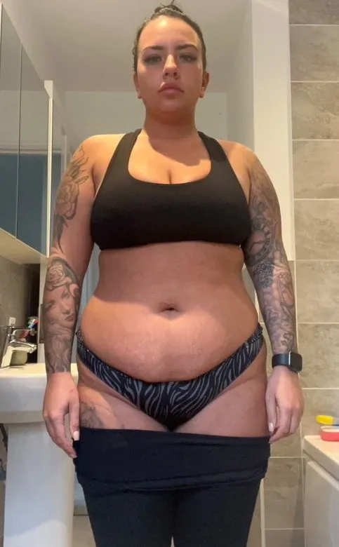 Chi gần 250.000.000VNĐ để phẫu thuật thẩm mỹ t&ocirc;i kh&ocirc;ng hề hối hận, diện mạo hiện tại đ&uacute;ng chuẩn "lột x&aacute;c", ai cũng n&oacute;i qu&aacute; đ&uacute;ng đắn- Ảnh 2.