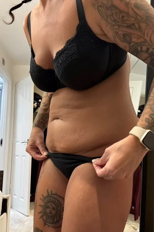 Chi gần 250.000.000VNĐ để phẫu thuật thẩm mỹ t&ocirc;i kh&ocirc;ng hề hối hận, diện mạo hiện tại đ&uacute;ng chuẩn "lột x&aacute;c", ai cũng n&oacute;i qu&aacute; đ&uacute;ng đắn- Ảnh 3.