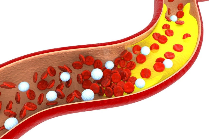 Mạch m&aacute;u gi&agrave; đi ch&iacute;nh l&agrave; l&yacute; do bạn gi&agrave; nhanh: L&agrave;m ngay 4 việc để mạch m&aacute;u sạch v&agrave; khỏe- Ảnh 1.