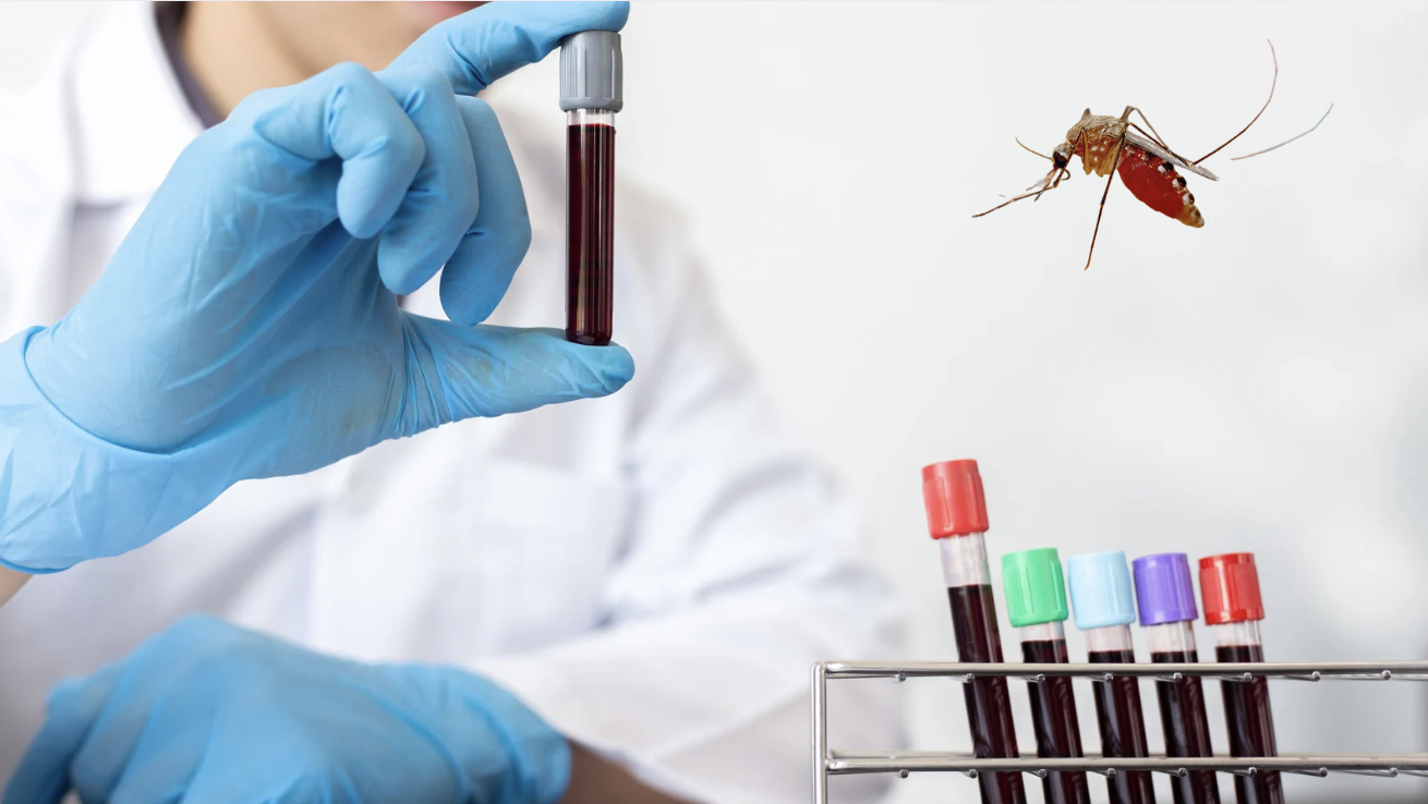 Có nên đi xét nghiệm Chikungunya? - Ảnh 1.