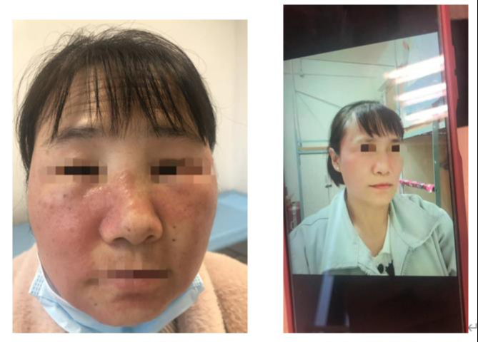 Người Phụ Nữ Cấp Cứu Với Khuôn Mặt Biến Dạng: Bác Sĩ Thốt Lên Người Phụ Nữ Cấp Cứu Với Khuôn Mặt Biến Dạng: Bác Sĩ Thốt Lên