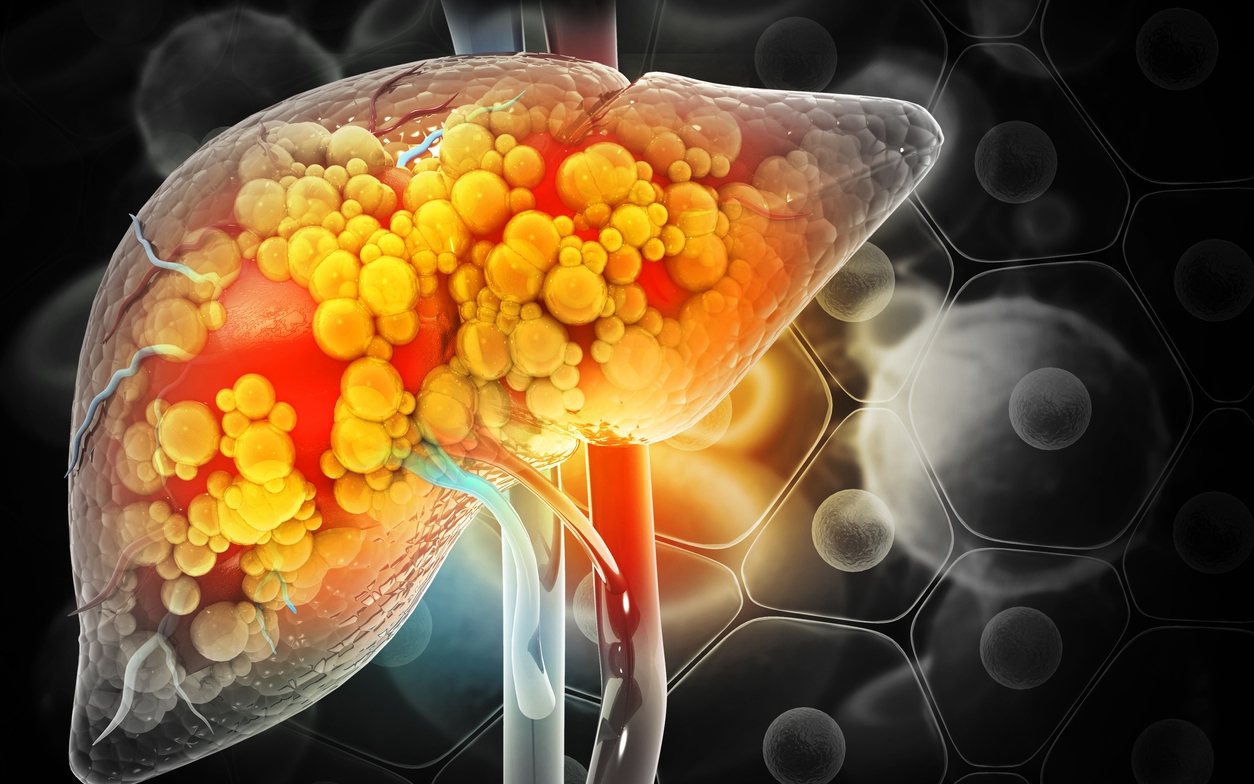 Người có gan yếu thường có 7 thói quen này: Cái cuối cùng nhiều người không ngờ tới - Ảnh 8.