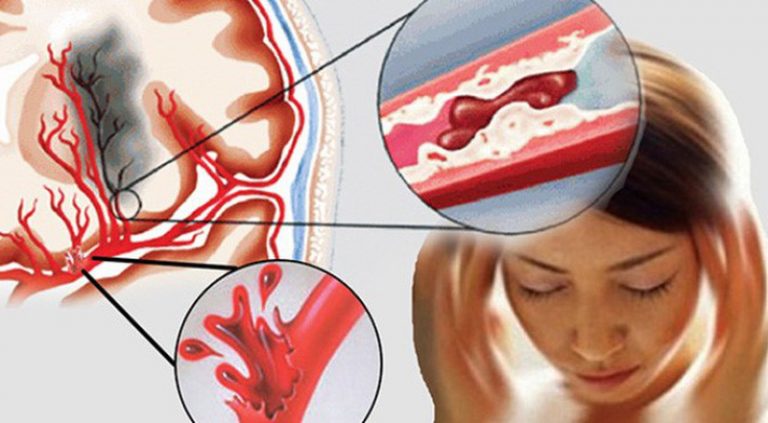 Nữ Mc Đột Ngột Qua Đời Ở Tuổi 27: Cảnh Báo Thói Quen Sống Âm Thầm Nữ Mc Đột Ngột Qua Đời Ở Tuổi 27: Cảnh Báo Thói Quen Sống Âm Thầm